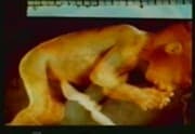 Embryo